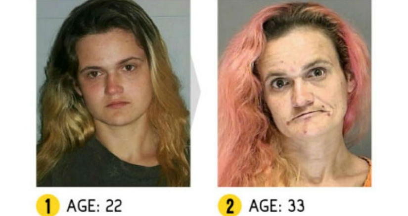 The result is obvious — how a person's appearance changes because of drugs