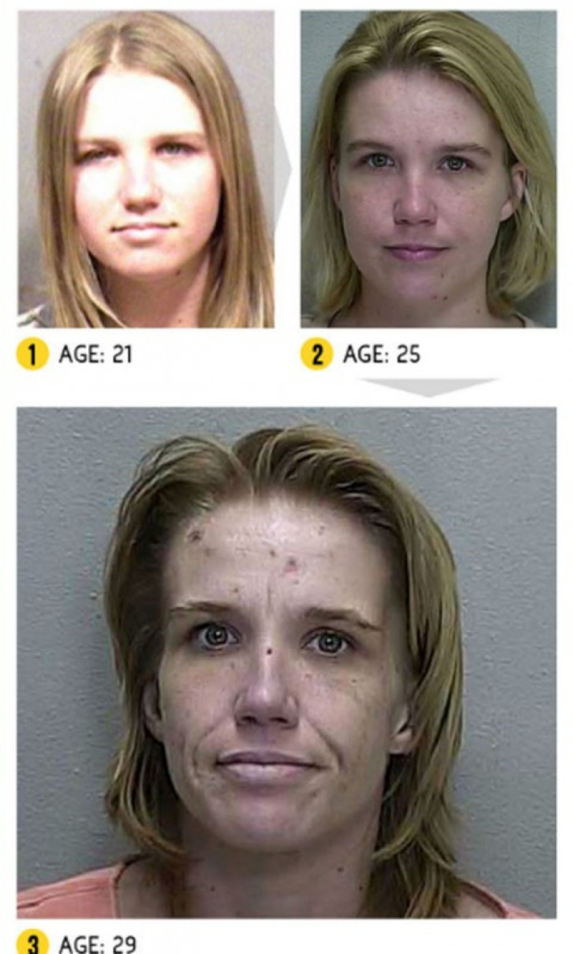 The result is obvious — how a person's appearance changes because of drugs