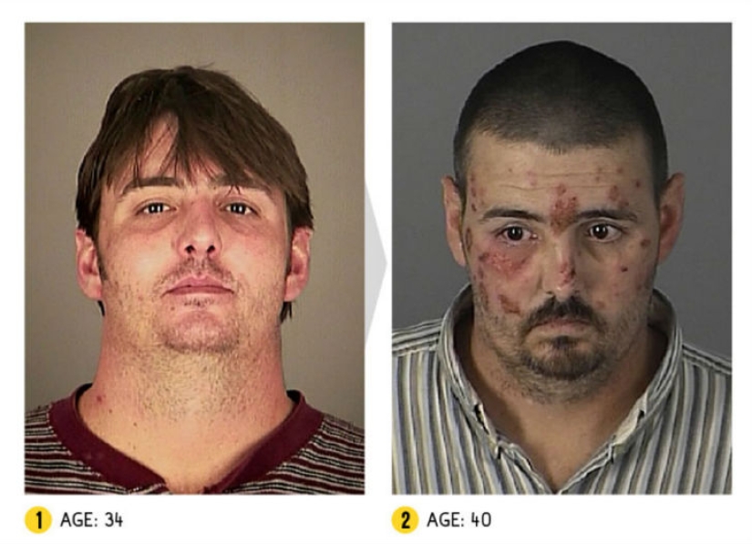 The result is obvious — how a person's appearance changes because of drugs
