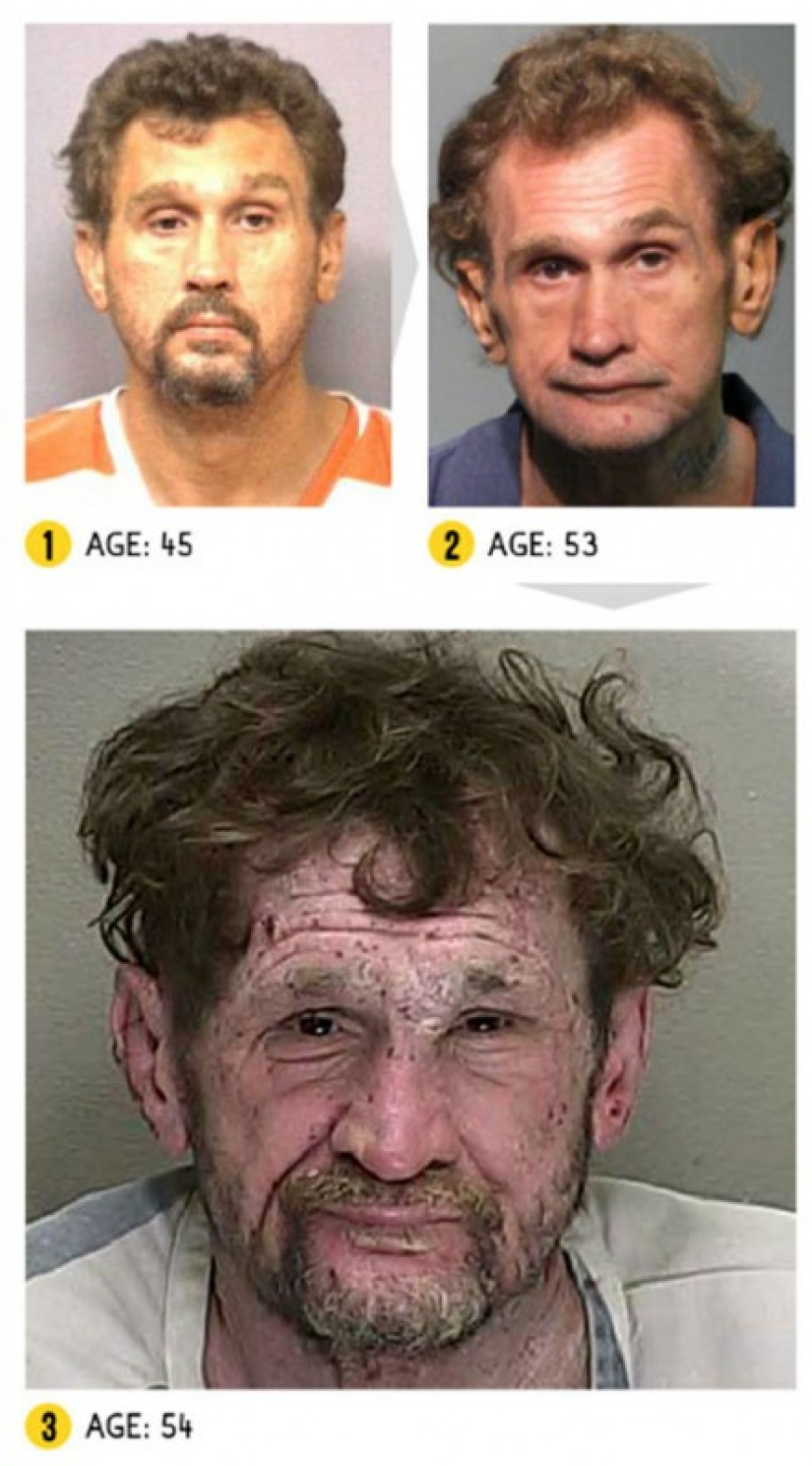 The result is obvious — how a person's appearance changes because of drugs