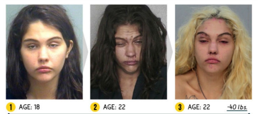 The result is obvious — how a person's appearance changes because of drugs