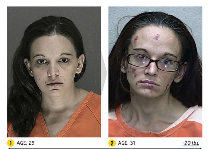 The result is obvious — how a person's appearance changes because of drugs