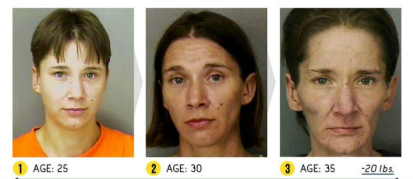 The result is obvious — how a person's appearance changes because of drugs