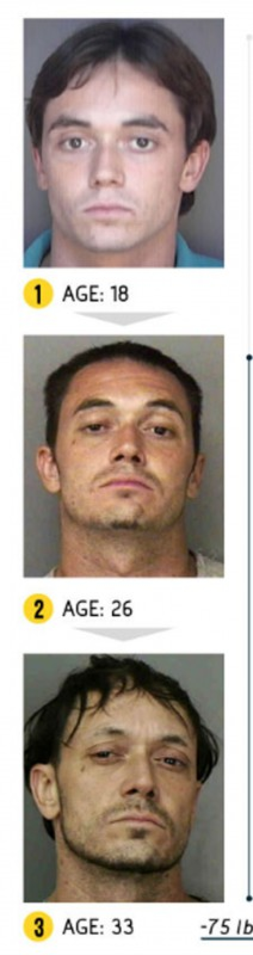 The result is obvious — how a person's appearance changes because of drugs