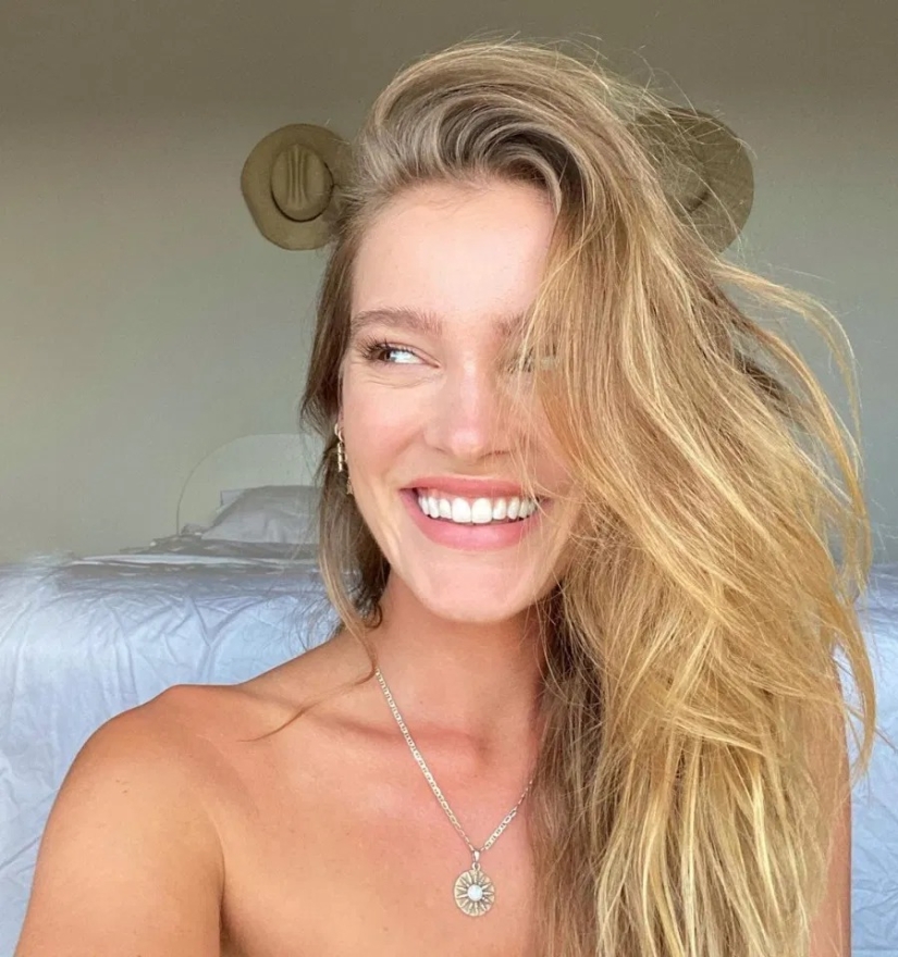 The result is obvious: the Sports Illustrated model got rid of acne, thanks to nutrition and meditation