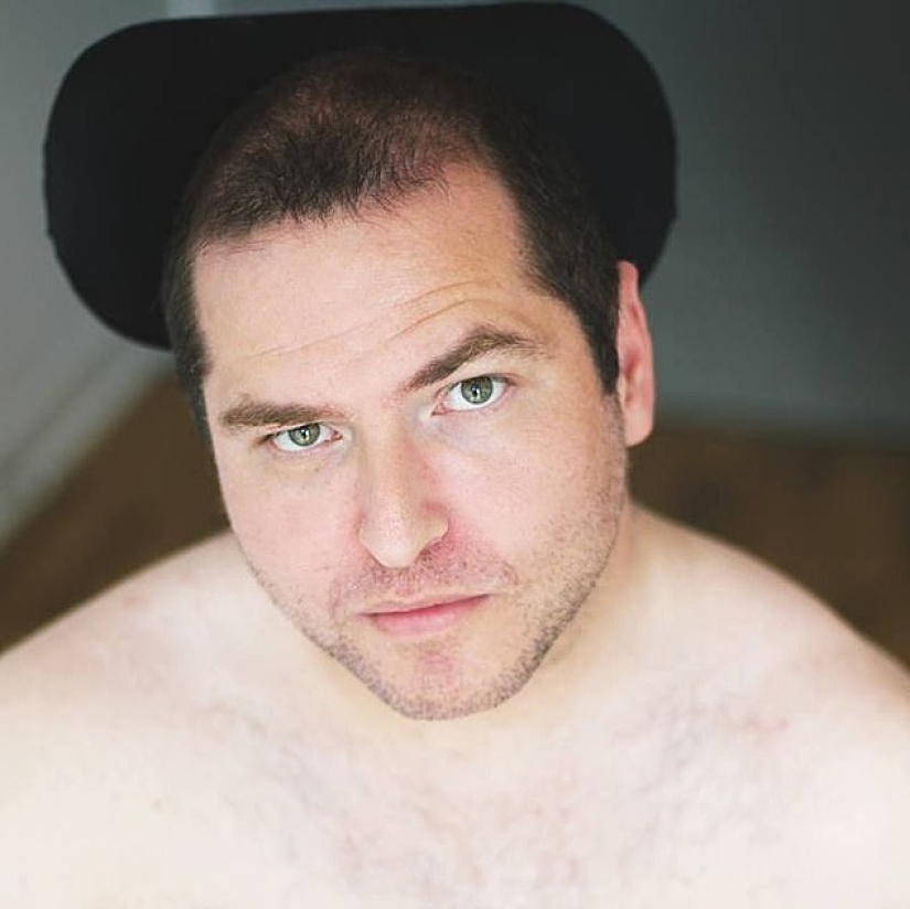 The right to beauty: people with disabilities share hot photos on social networks