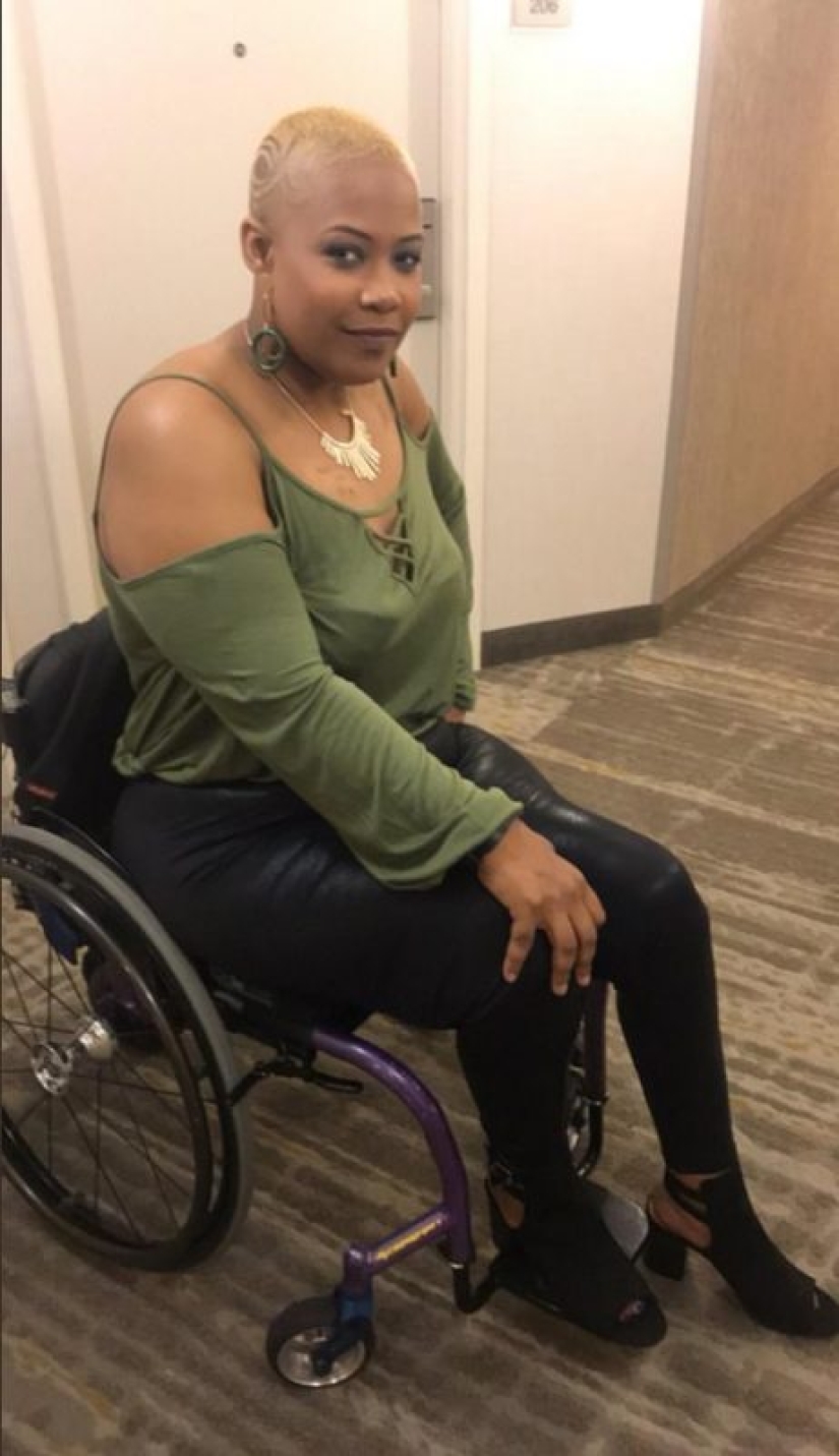 The right to beauty: people with disabilities share hot photos on social networks