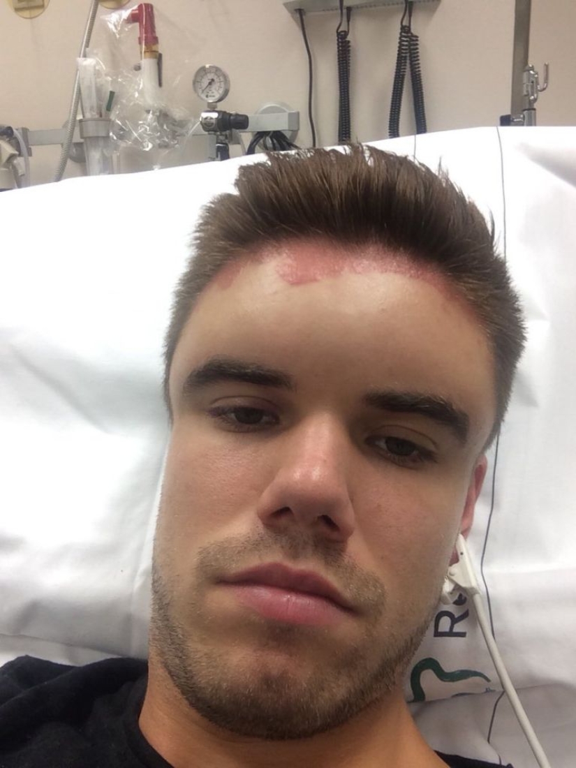 The Swede dyed his hair and turned into Frankenstein The Swede dyed his hair and turned into Frankenstein