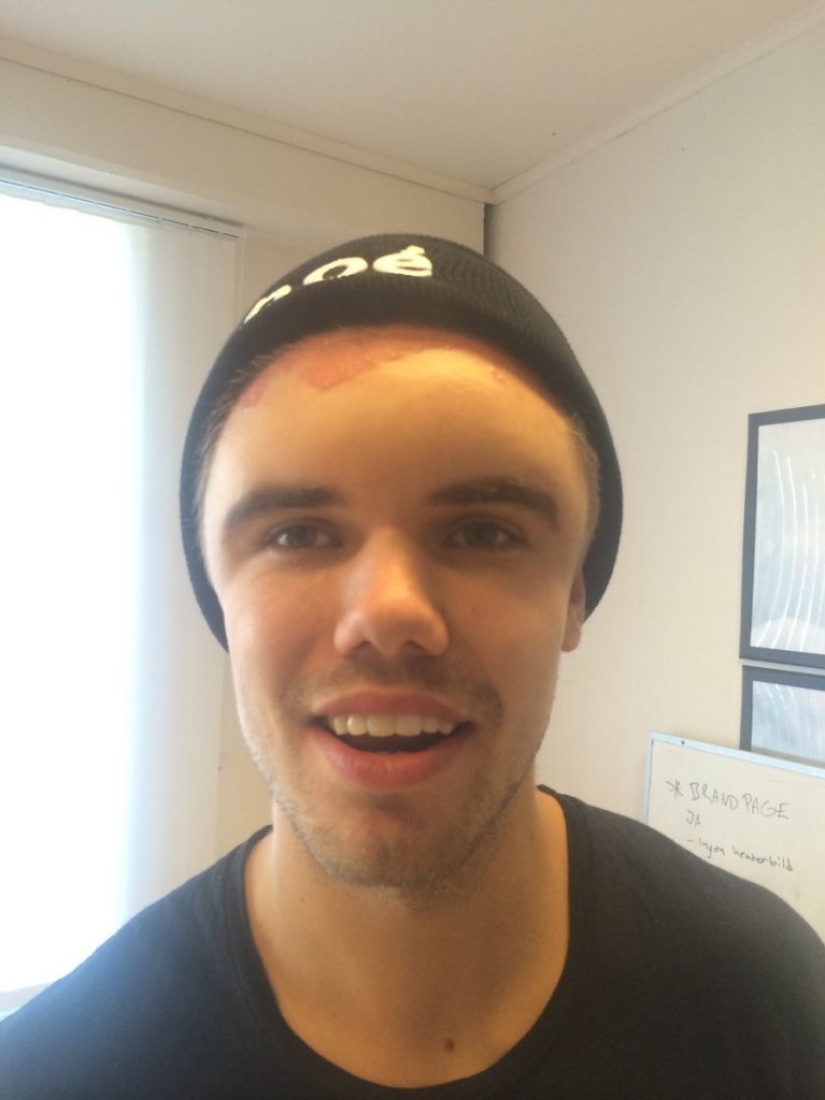 The Swede dyed his hair and turned into Frankenstein The Swede dyed his hair and turned into Frankenstein