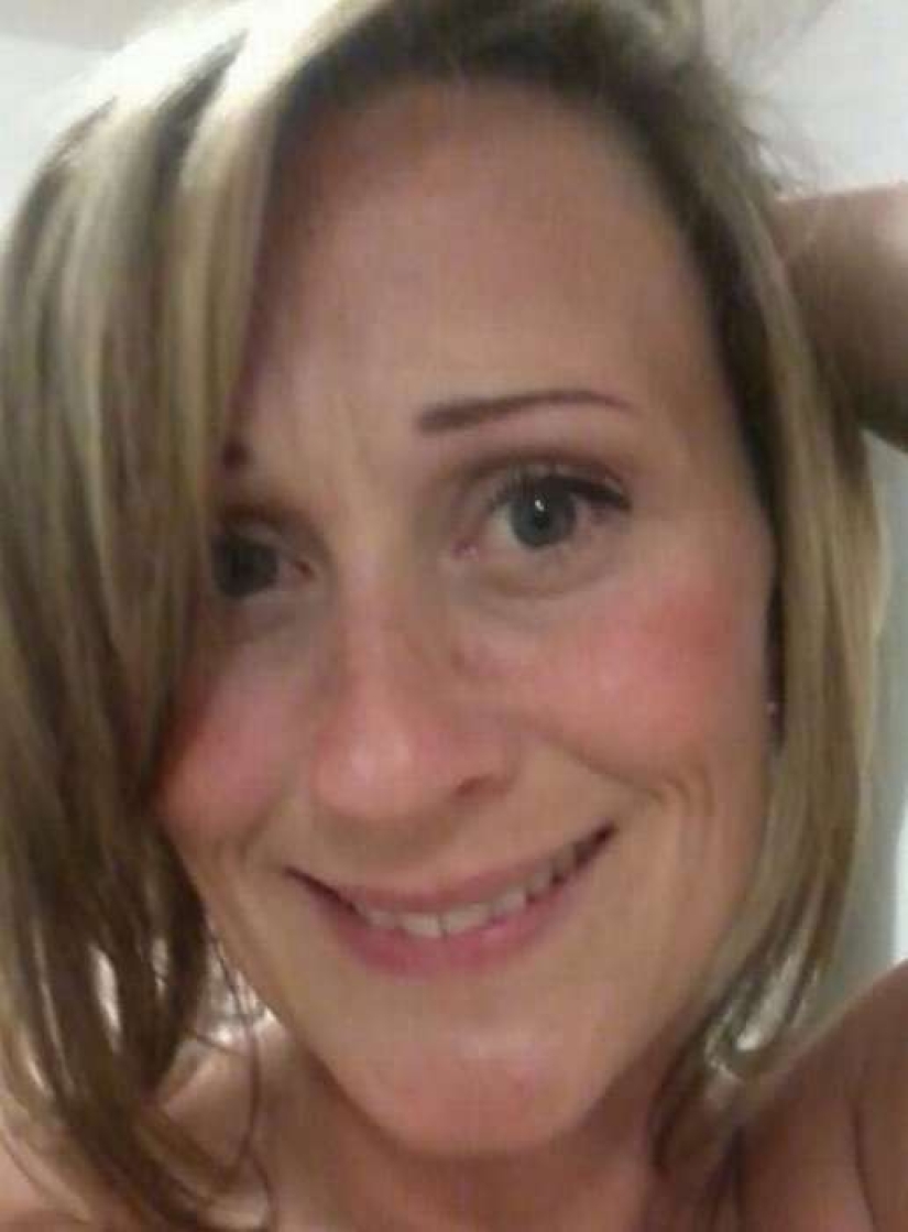 The woman liked retouched selfies so much that she became obsessed with plastic surgery The woman liked retouched selfies so much that she became obsessed with plastic surgery