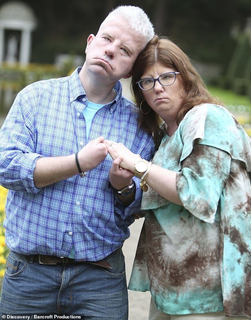 They can't smile, but they know how to love: a man and a woman with a rare facial anomaly decided to get married