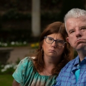 They can't smile, but they know how to love: a man and a woman with a rare facial anomaly decided to get married