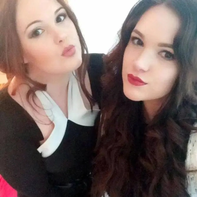 Todo lo ingenioso es simple: las hermanas gemelas ganaron un millón en un levantamiento de senos barato