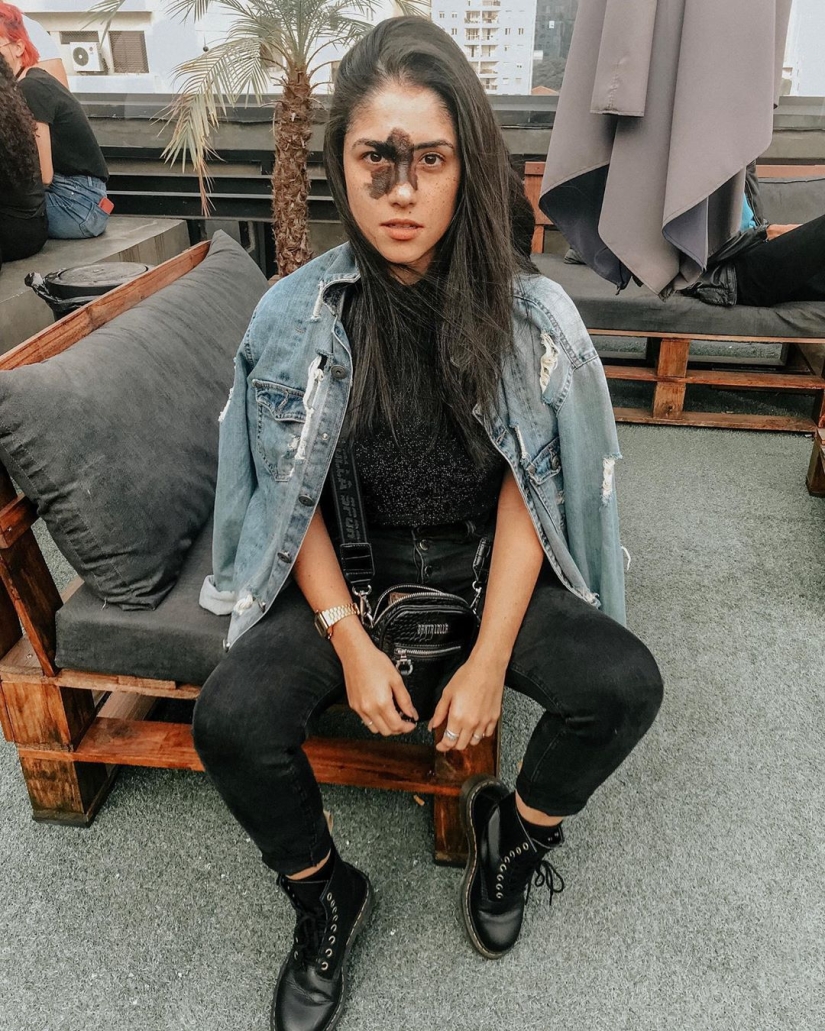 Todos se burlaron de esta chica por su marca de nacimiento, y ella tomó y se convirtió en modelo