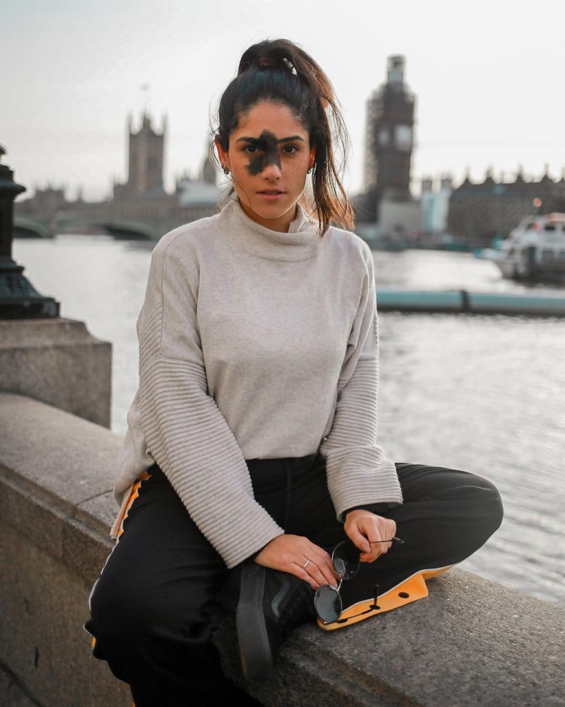 Todos se burlaron de esta chica por su marca de nacimiento, y ella tomó y se convirtió en modelo