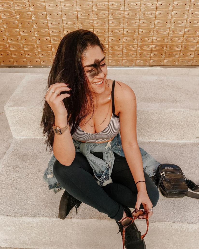 Todos se burlaron de esta chica por su marca de nacimiento, y ella tomó y se convirtió en modelo
