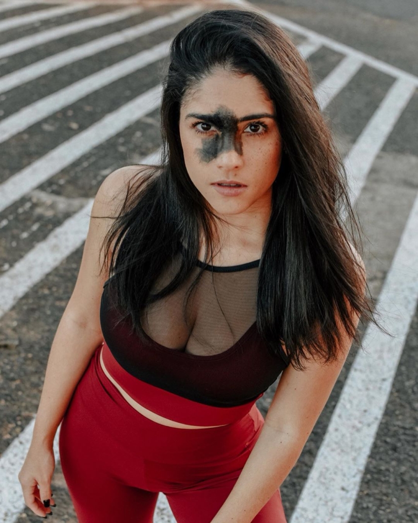 Todos se burlaron de esta chica por su marca de nacimiento, y ella tomó y se convirtió en modelo