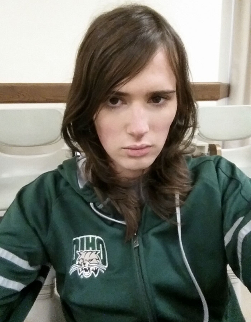 Transformation from man to woman: a gradual process that took 17 months