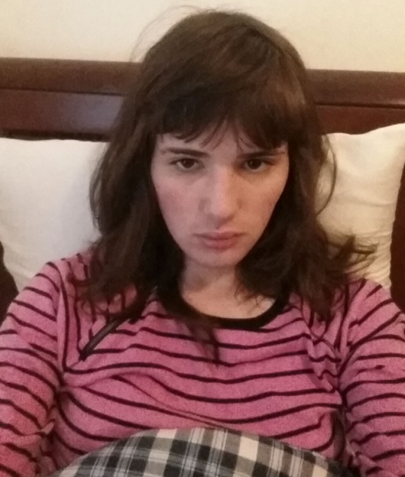 Transformation from man to woman: a gradual process that took 17 months