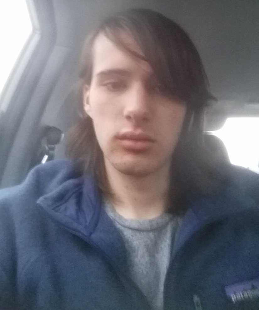 Transformation from man to woman: a gradual process that took 17 months