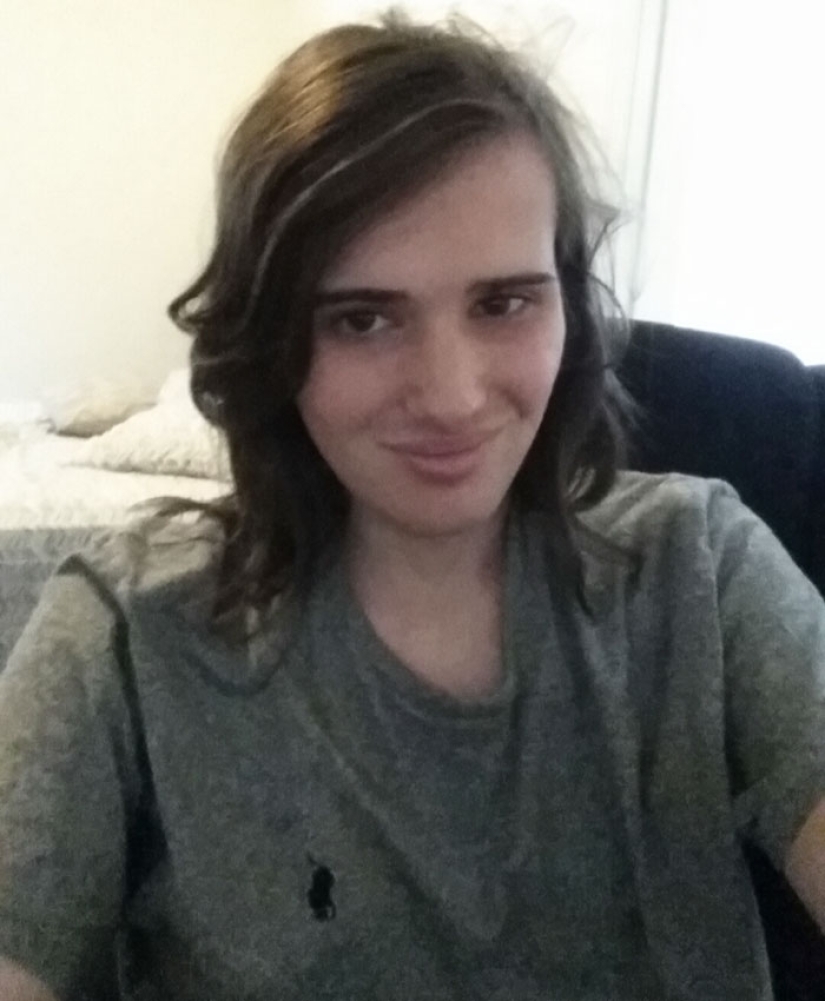 Transformation from man to woman: a gradual process that took 17 months