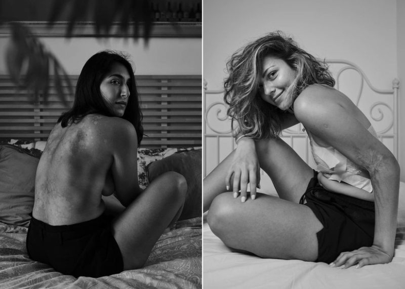 "¡ Tu fealdad es genial!": 5 personas que están orgullosas de las características de su apariencia