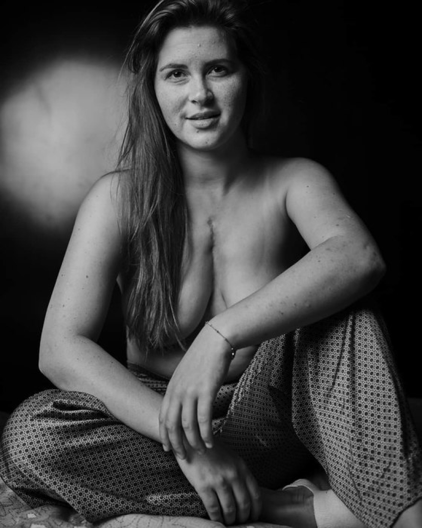 "¡ Tu fealdad es genial!": 5 personas que están orgullosas de las características de su apariencia