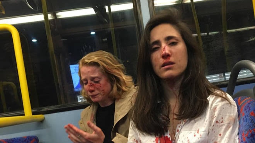 Two lesbians were beaten and robbed on the bus for not wanting to kiss