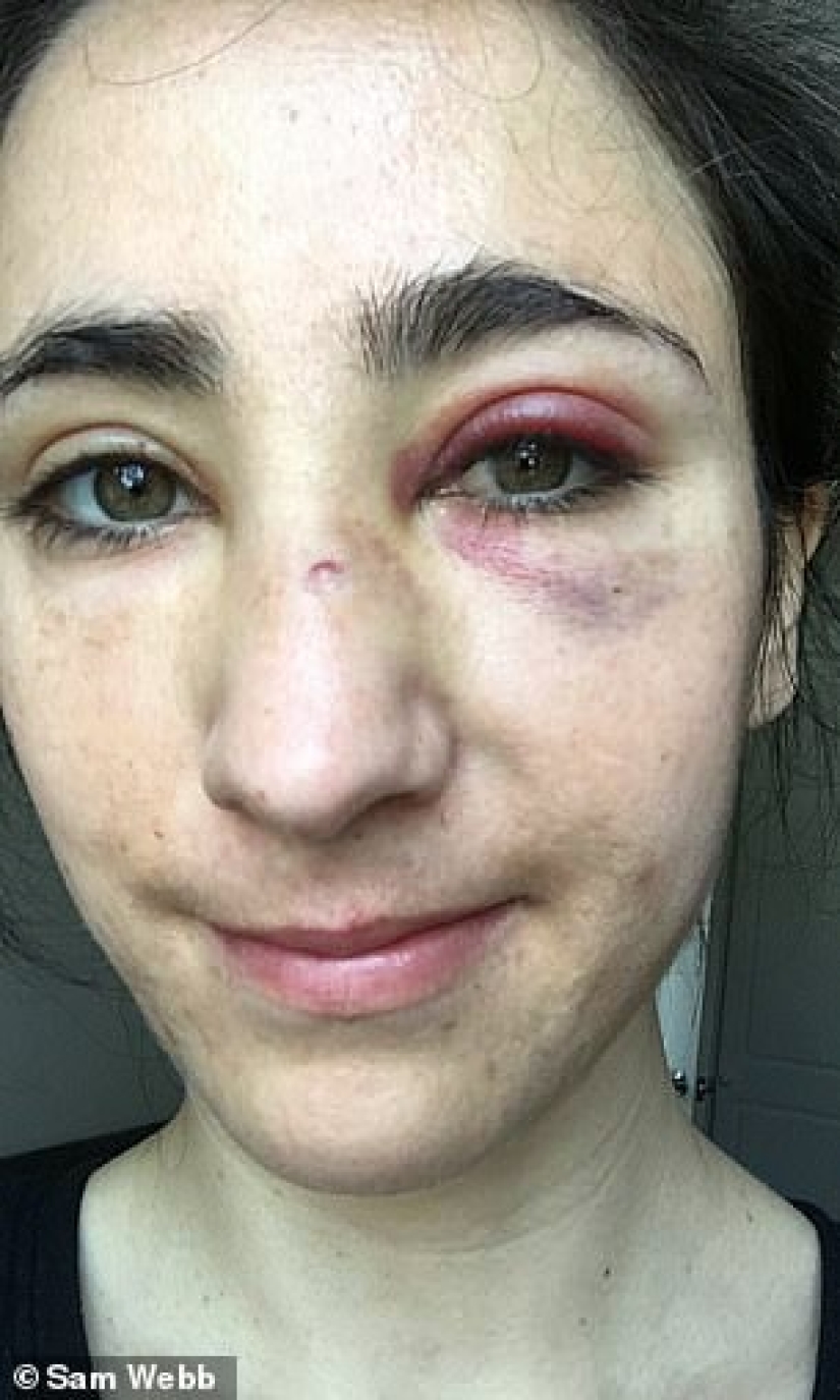 Two lesbians were beaten and robbed on the bus for not wanting to kiss