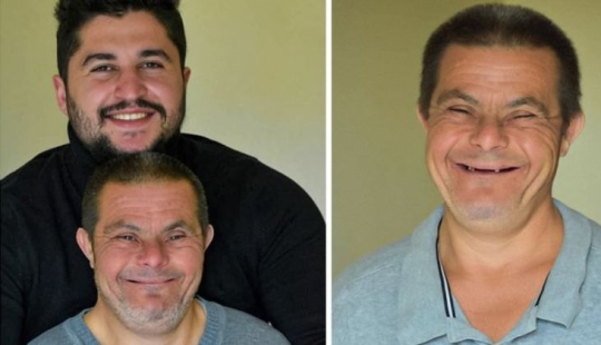 Un hombre con síndrome de Down se convirtió en padre y ahora está orgulloso de su hijo médico Un hombre con síndrome de Down se convirtió en padre y ahora está orgulloso de su hijo médico