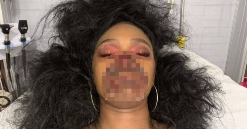 Una chica con maquillaje zombie realista engañó a los médicos Una chica con maquillaje zombie realista engañó a los médicos