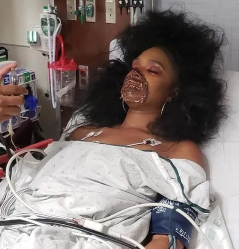 Una chica con maquillaje zombie realista engañó a los médicos Una chica con maquillaje zombie realista engañó a los médicos