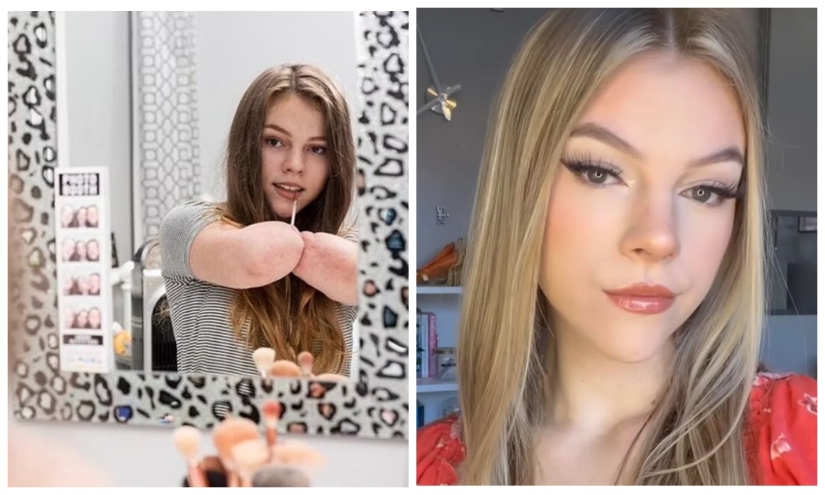 Una mujer británica a la que le amputaron todas sus extremidades lleva a cabo talleres de maquillaje Una mujer británica a la que le amputaron todas sus extremidades lleva a cabo talleres de maquillaje