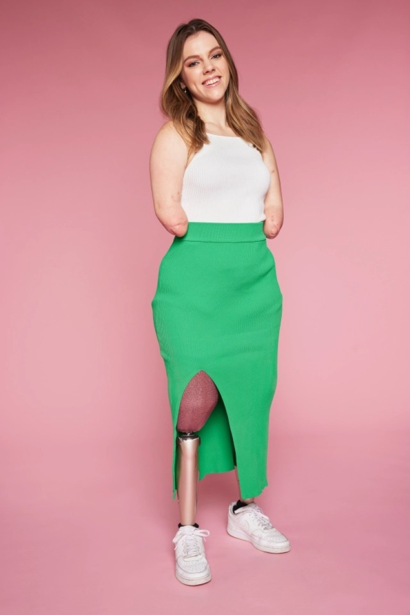 Una mujer británica a la que le amputaron todas sus extremidades lleva a cabo talleres de maquillaje Una mujer británica a la que le amputaron todas sus extremidades lleva a cabo talleres de maquillaje