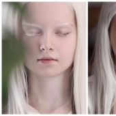 Una niña albina de Chechenia golpeó con su apariencia única