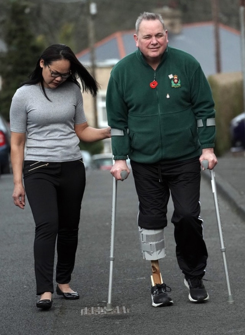 Una pierna nueva con sus propias manos: una mujer hizo una prótesis para su marido con materiales improvisados