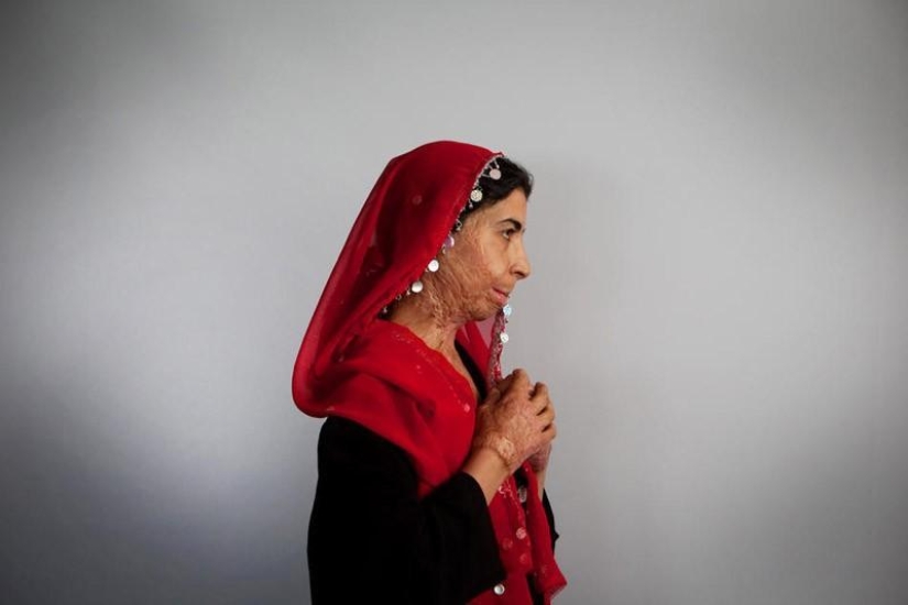 Unequal marriage in Asian style