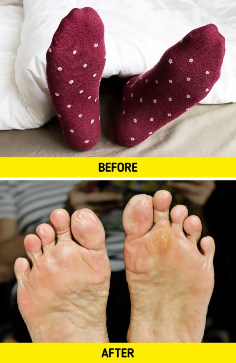 What can happen if you sleep in socks What can happen if you sleep in socks