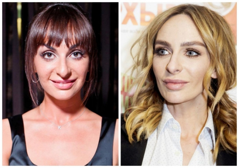 What did the primates of Russian show business look like before they made plastic surgery