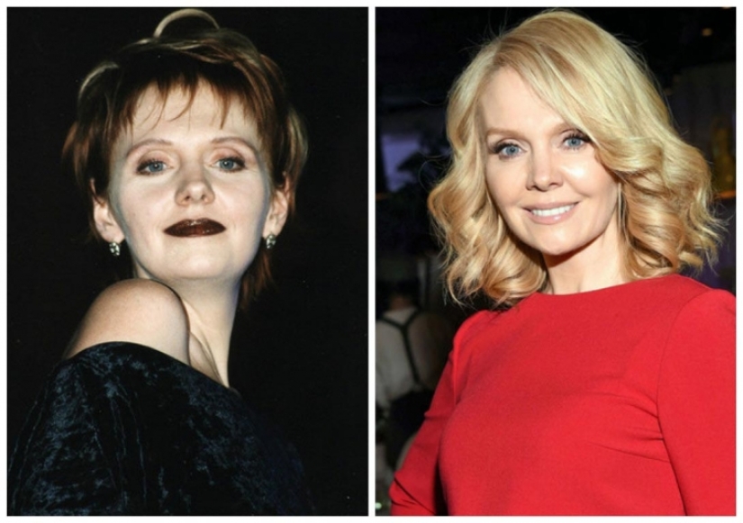 What did the primates of Russian show business look like before they made plastic surgery