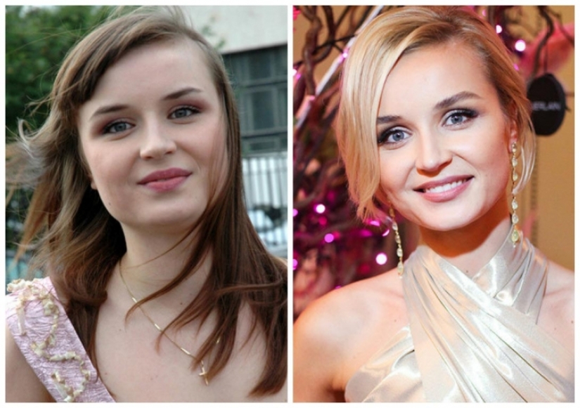 What did the primates of Russian show business look like before they made plastic surgery