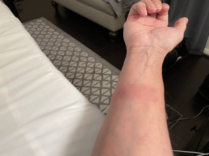 What do you know about beauty? One-legged girl got into the final of "Miss Italy" What do you know about beauty? One-legged girl got into the final of "Miss Italy"