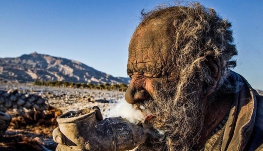 What does a person who has not washed for 60 years look like