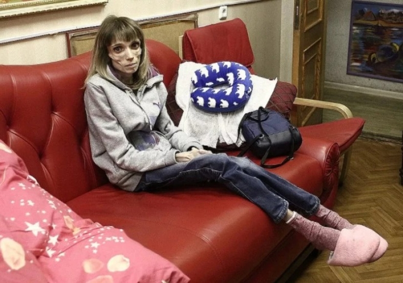 What does Kristina Koryagina look like now — a Russian woman who weighed 17 kg What does Kristina Koryagina look like now — a Russian woman who weighed 17 kg