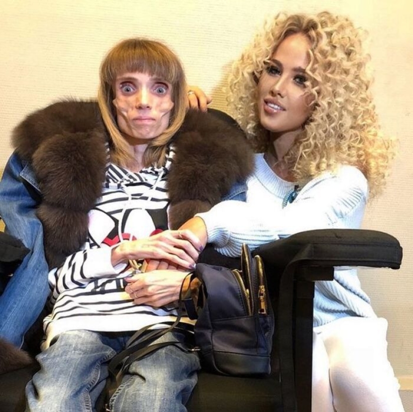 What does Kristina Koryagina look like now — a Russian woman who weighed 17 kg What does Kristina Koryagina look like now — a Russian woman who weighed 17 kg