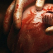 What does the boy from the famous photo "The Hand of Hope" look like today