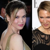 What happened to René Zellweger?