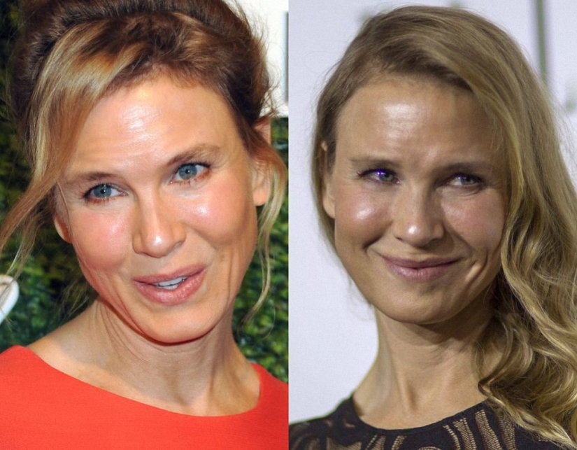 What happened to René Zellweger?