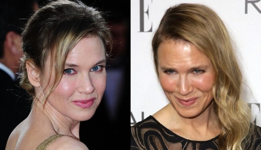 What happened to René Zellweger? What happened to René Zellweger?