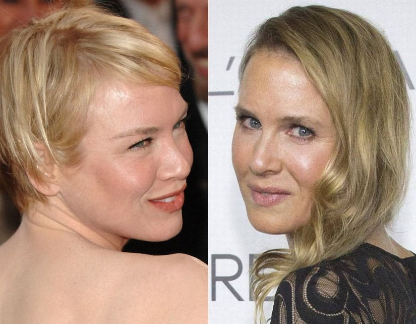 What happened to René Zellweger?
